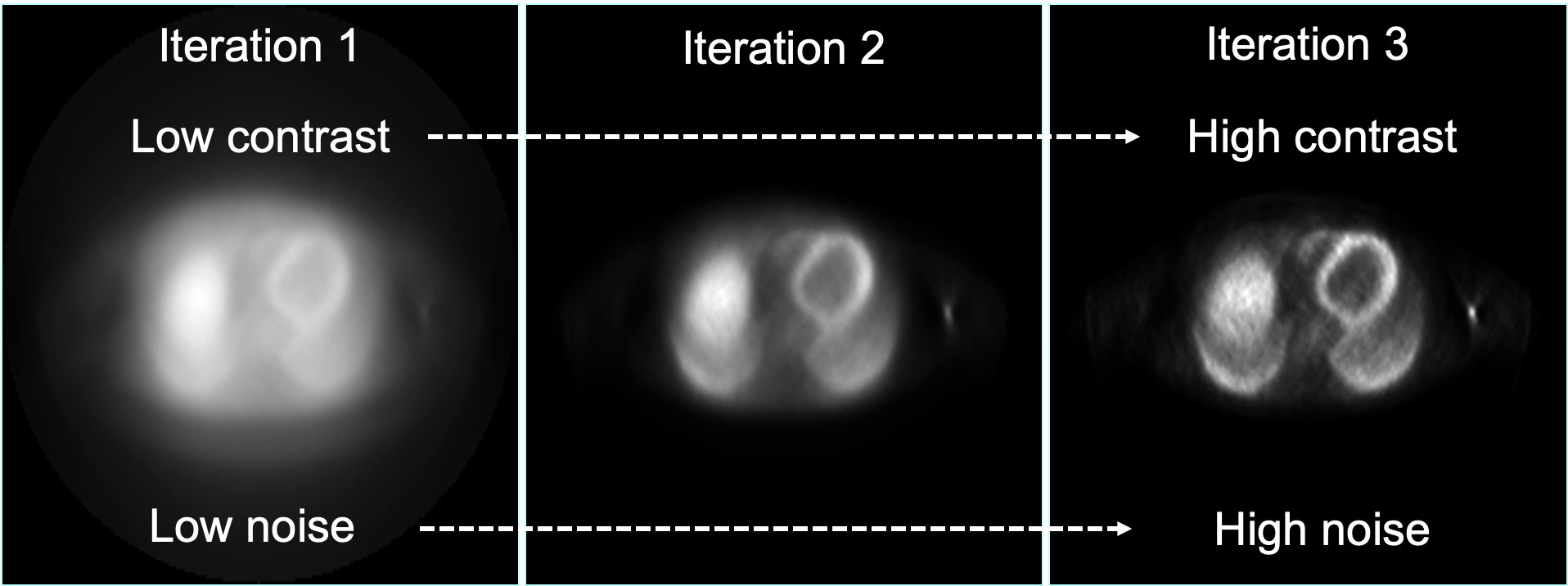 <p>what is it? </p><p><span>difference between high and low areas of radiopharmaceutical uptake </span></p><p></p><p><span>how to increase it?</span></p><p><span>more iterations - although have to optimise for noise also</span></p><p></p><p></p>
