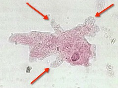 false feet - how amoebas move and engulf food