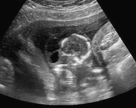 <p><span><span>The etiology of this abnormality is typically:</span></span></p>