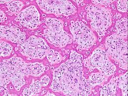 <p>Thin struts or plates forming the lattice of spongy bone.</p>