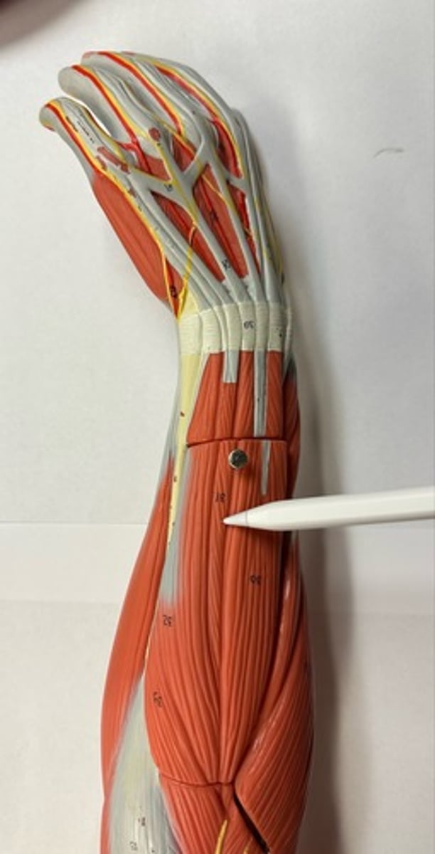 <p>What are the (2) attachments of the Extensor Digiti Minimi?</p>