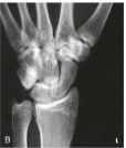 <p>What projection, position, and anatomy is this? </p>