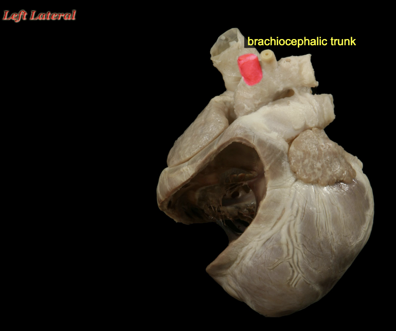 <p><span>The first branch from the aortic arch is the brachiocephalic trunk, which inclines to the right side of midline, passing ventral to the trachea. It will give rise to the two common carotid arteries and the right subclavian artery, as well as a variable number of small arteries that supply nearby structures of the cranial mediastinum.</span></p>