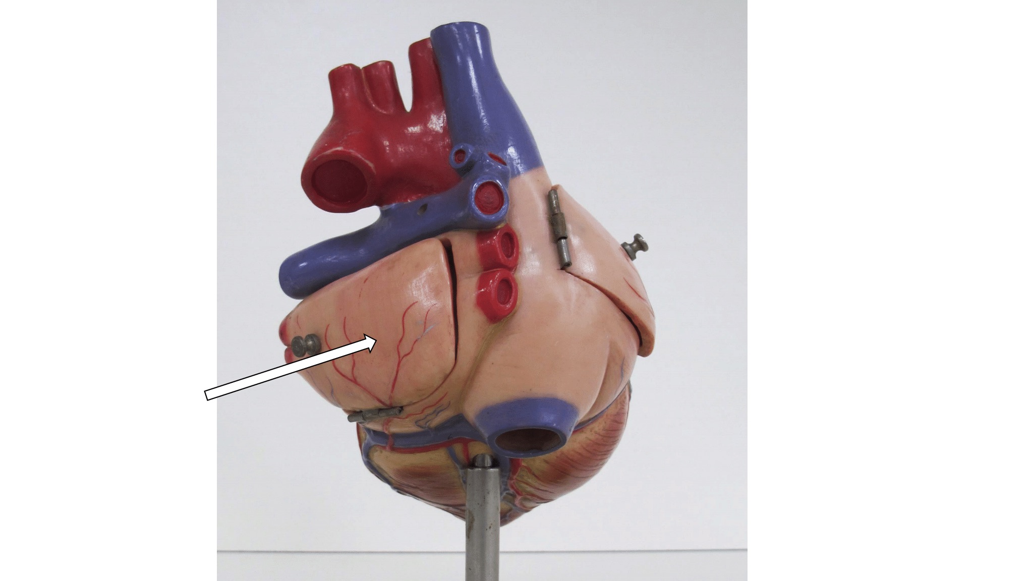 <p>hartholte (dorso/lateraal zicht + specifiek + Latijns)</p>