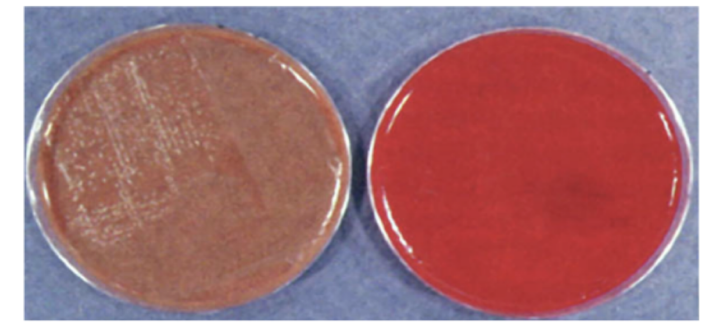 <p>contains a complex of organic substances to grow fastidious organiusms</p><ul><li><p>Media which specific nutrients are added: blood, serum, hemoglobin, or special growth factors</p></li><li><p>blood agar and brain-heart infusion (BHI) agar</p></li></ul><p></p>