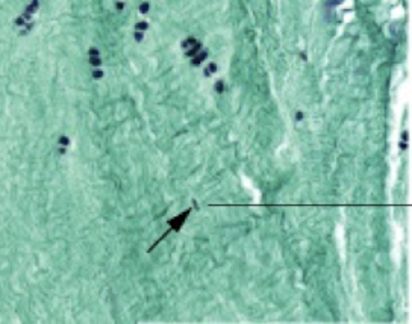 <p>What does the arrow point to?</p>