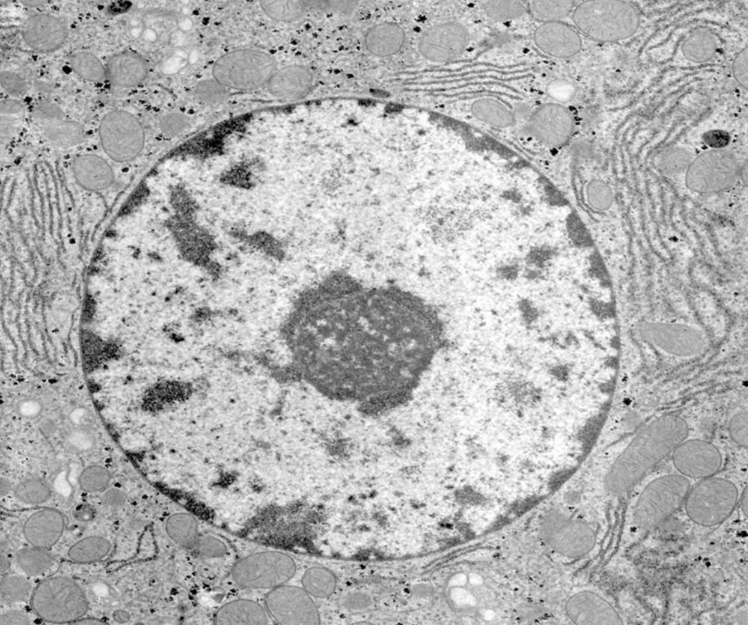<ul><li><p>chromatin</p></li><li><p>equal amounts of protein and DNA</p><ul><li><p>→ to be able to see it</p></li><li><p>attracts dye easily which is fab</p></li></ul></li></ul><p><em>this is why chromatin is called chromatin 'chrome=colour</em></p><p></p>