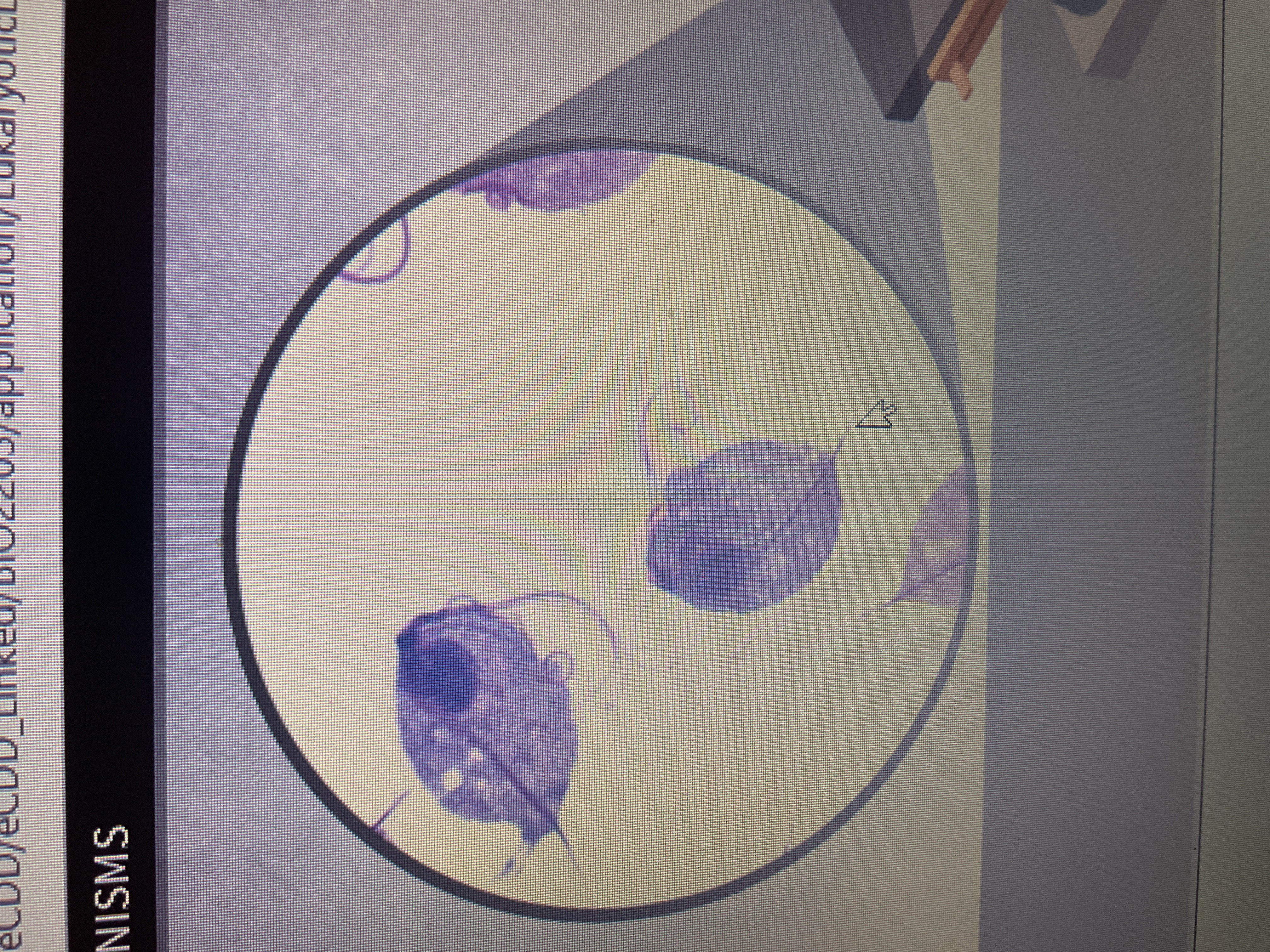 <p>Protozoa</p><p>trichamonas</p><p>sti causing discharge</p>