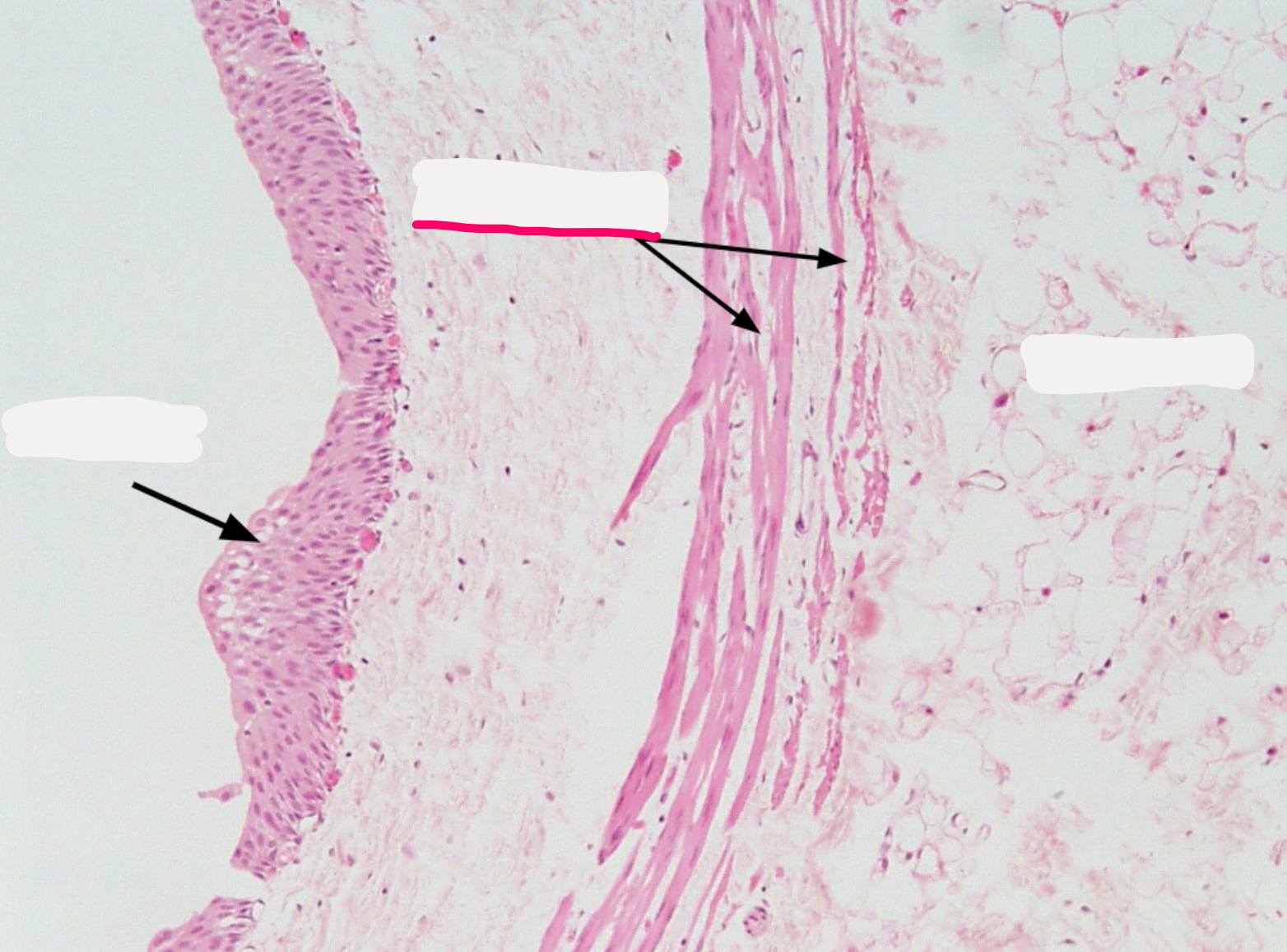 <ol><li><p><strong>Muscularis</strong> </p></li></ol><p></p>