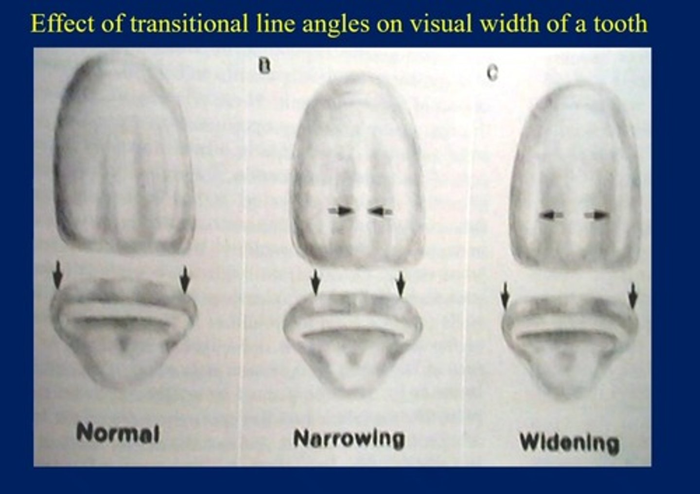 knowt flashcard image