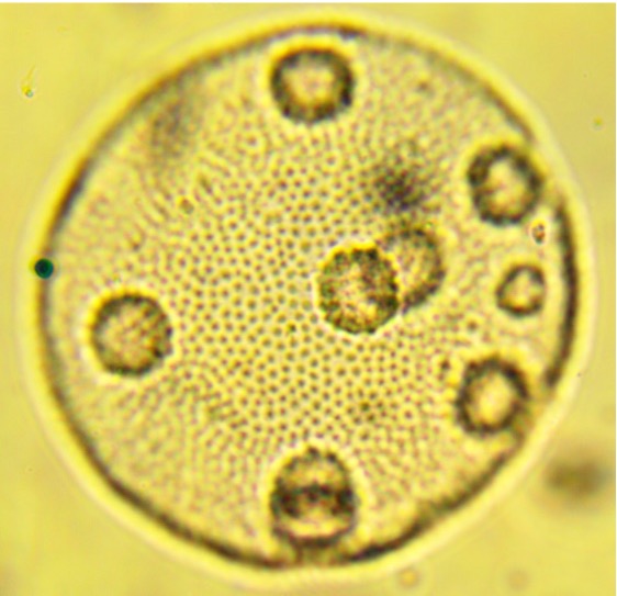 <p>What species is this?</p><ul><li><p>Volvox</p></li><li><p>Oedogonium</p></li><li><p>Chlamydomonas</p></li><li><p>Plasmodium</p></li></ul><p></p>