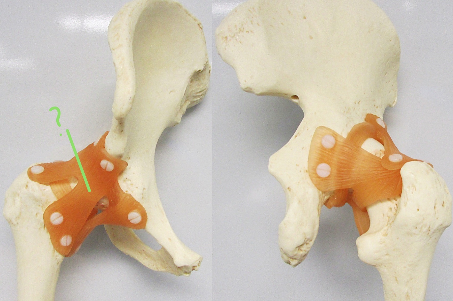 <p>Determine the part of the hip joint w/ ligament highlighted</p>