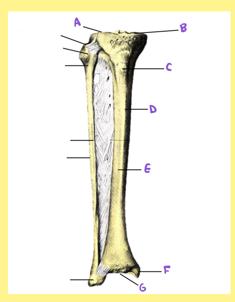 <p><u>Name the following</u>:</p><ul><li><p>Bone?</p></li><li><p>Side?</p></li><li><p>View?</p></li><li><p>C?</p></li></ul><p></p>