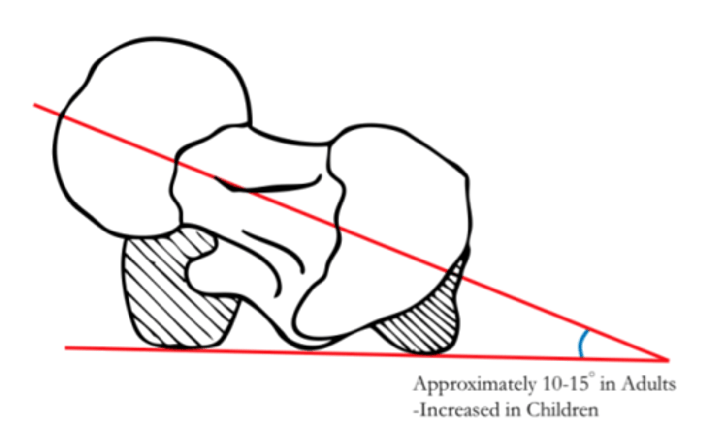 <p>angle of the head/neck of the femur with a line through the femoral condyles</p><p>*rotation in transverse plane</p><p>infant = 30-40 degrees</p><p>adult = 10-15/20 degrees</p><p>(M=15, F=18)</p>