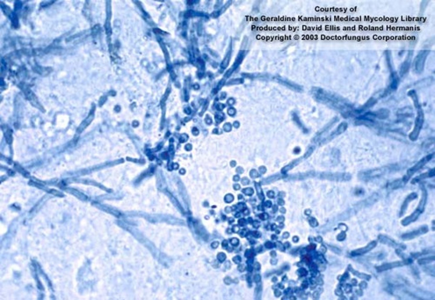 <p>tinea VERSICOLOR</p><p>--lipophilic: needs lipid overlay to grow</p><p>Conidia and hyphae: spaghetti and meatballs</p><p>--normal flora in 90% of adults</p><p>*yeast-like fungus</p>