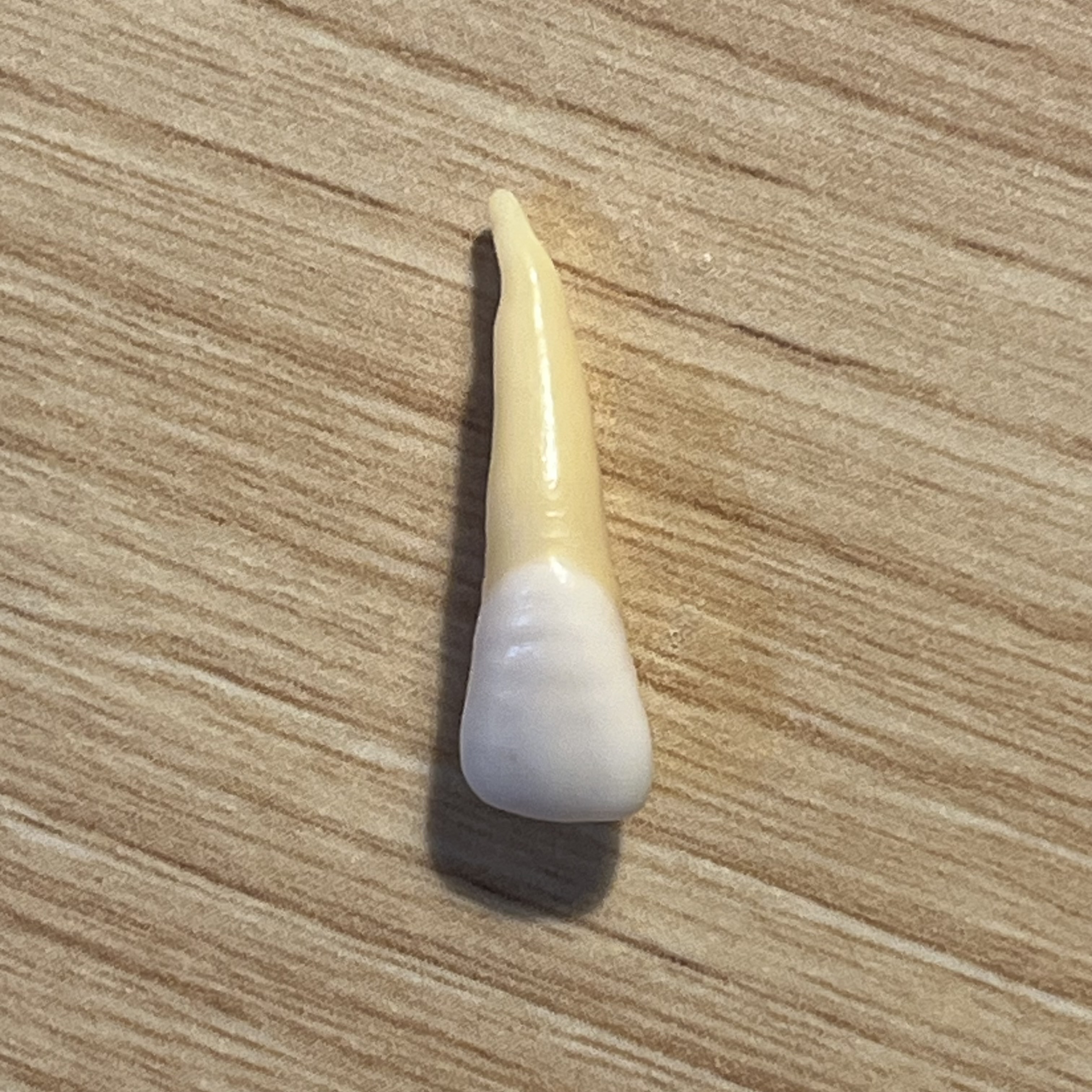 <p>What tooth is this (with view)?</p>