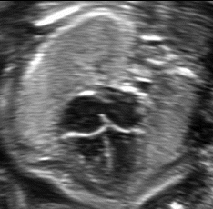 <p><span style="line-height: 21.6px;"><strong>Evaluate fetal situs</strong>; what is the presentation of the image?</span></p>