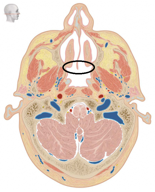 term image