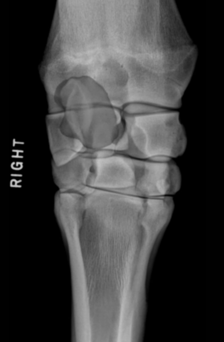 <p>What bone is highlighted?</p>