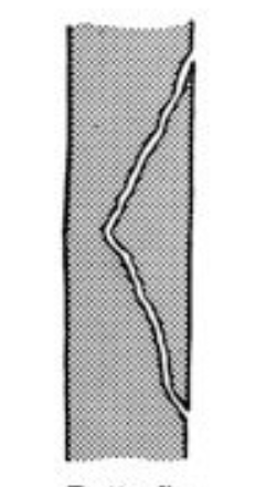<p>What classification of fracture is this?</p>
