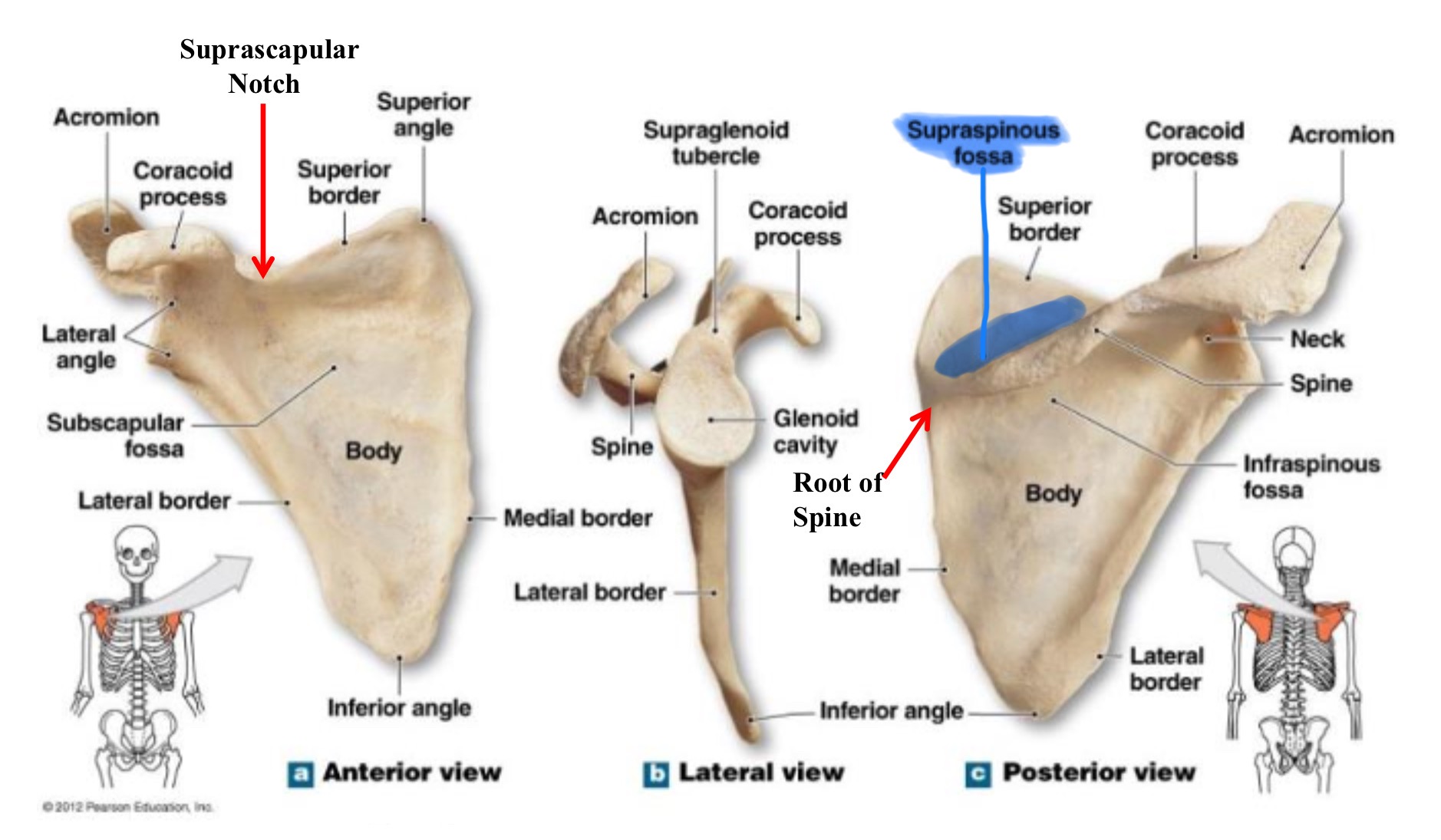 <p>supraspinous fossa of scapula</p>