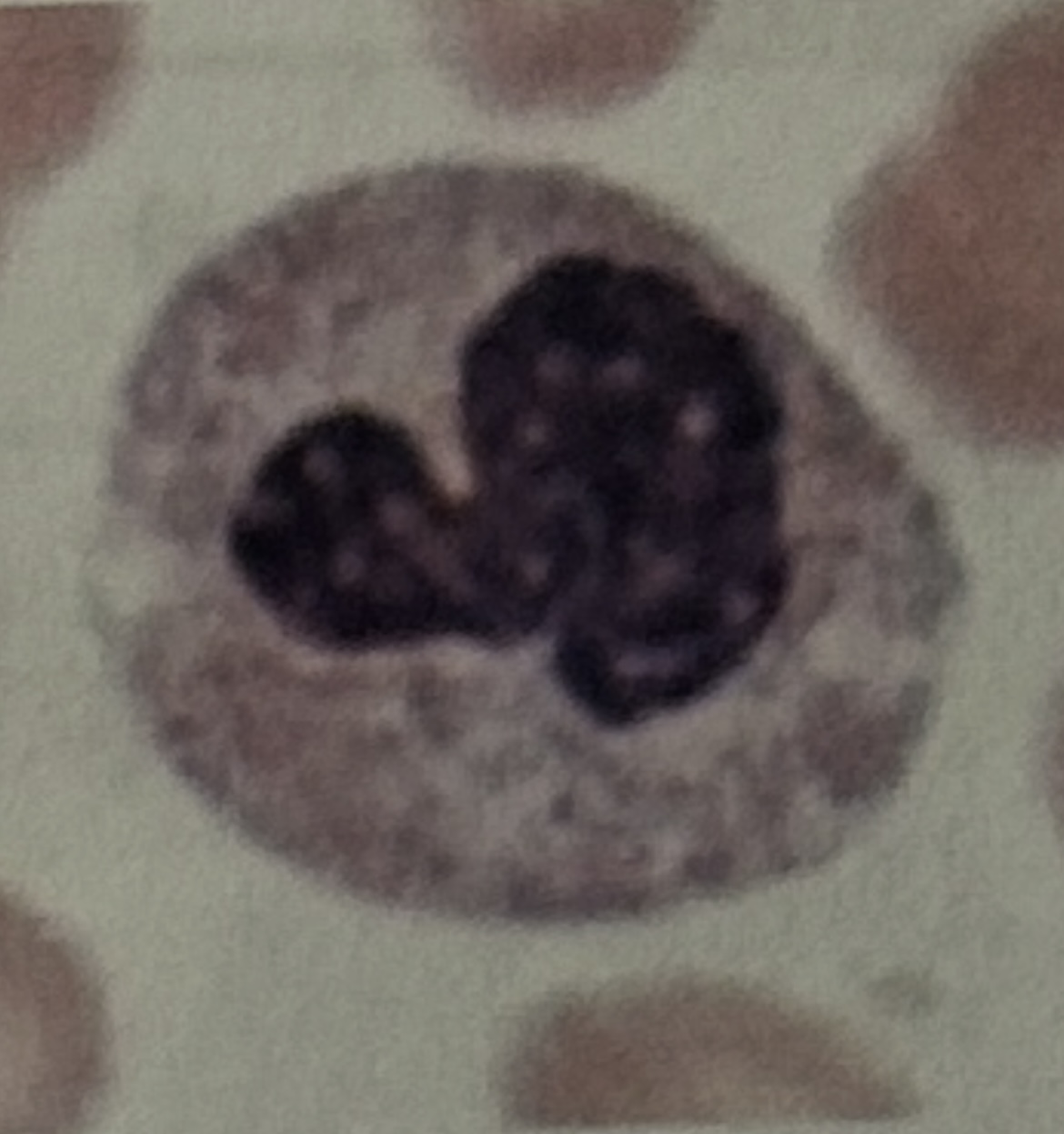 <p>WBC</p>