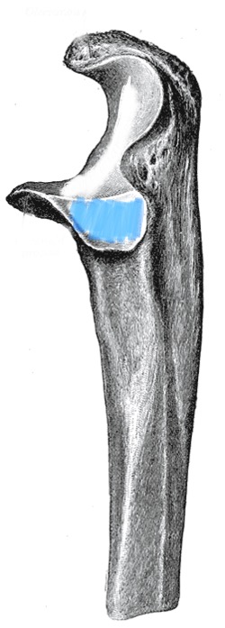 term image