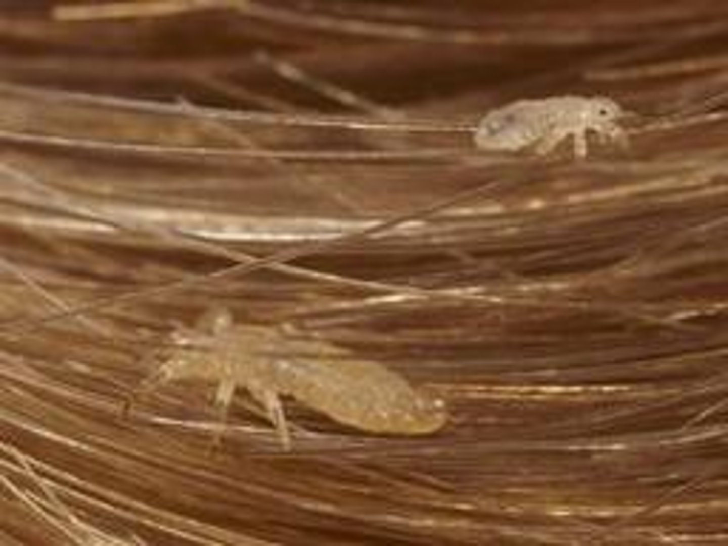 <p>infestation with lice; Parasitic infection; Client education is essential when treating; be informed that itching may continue for up to a week after successful treatment because of the slow resolution of the inflammatory reaction caused by the lice infestation.</p>