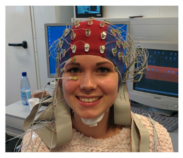 <p>It measures graded potentials (EPSPs and IPSPs) of similarly orientated neurons that are simultaneously active.</p><ul><li><p><span style="color: #21f708">High temporal resolution (~1ms)</span></p></li><li><p><span style="color: red">Poor spatial resolution (~1cm)</span></p></li><li><p><span style="color: #0ffa03">inexpensive, noninvasive</span></p></li></ul><p>shown as scribbly lines (^~~^~^~~).</p><ul><li><p>dynamic imaging technique: record activity in the brain over time. </p></li></ul><p></p>