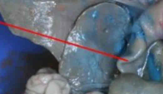 <p>Identify this structure</p>