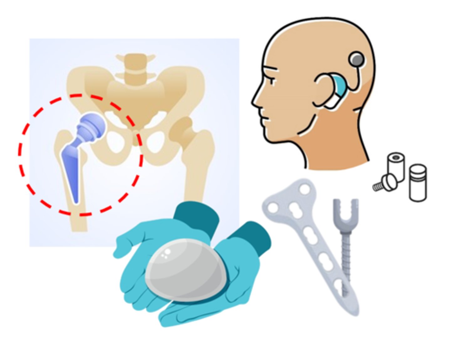 <p>instruments that are fully or partially introduced into the body (called explants once they're removed)</p>