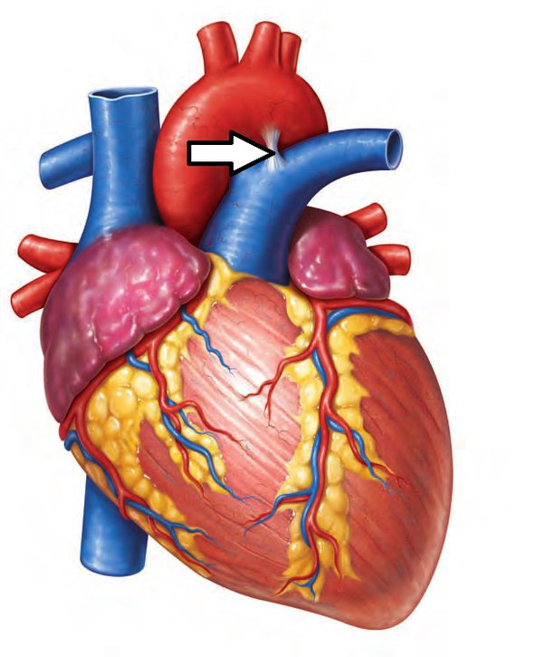 <p>Adult remnant of fetal ductus arteriosus; connects pulmonary trunk to aortic arch.</p>