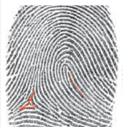 <p>here: loop, ulnar, one delta, one core</p>