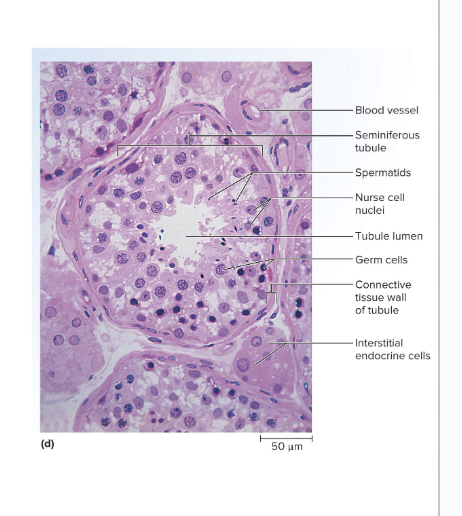 <p><span style="background-color: transparent;"><span>Nurse cells are</span><strong><span> </span></strong><span>in between the germ cells</span></span></p><ul><li><p><span style="background-color: transparent;"><span>Protect the germ cells, and promote their development</span></span></p></li><li><p><span style="background-color: transparent;"><span>Germ cells depend on them for nutrients, waste removal, growth factors, and other needs</span></span></p></li></ul><p></p>