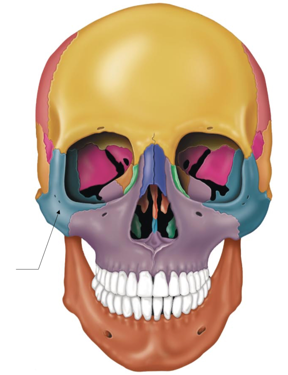 term image