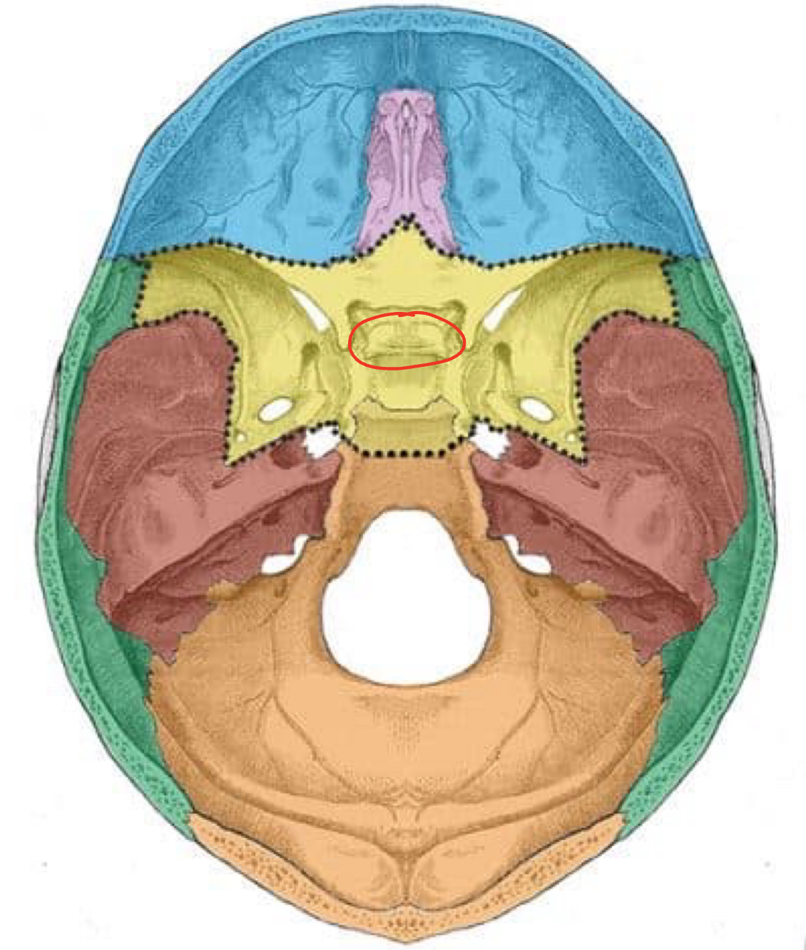 term image