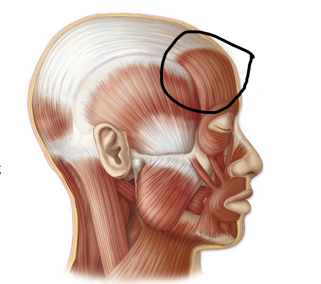 <p>what facial expression bone is this?</p>