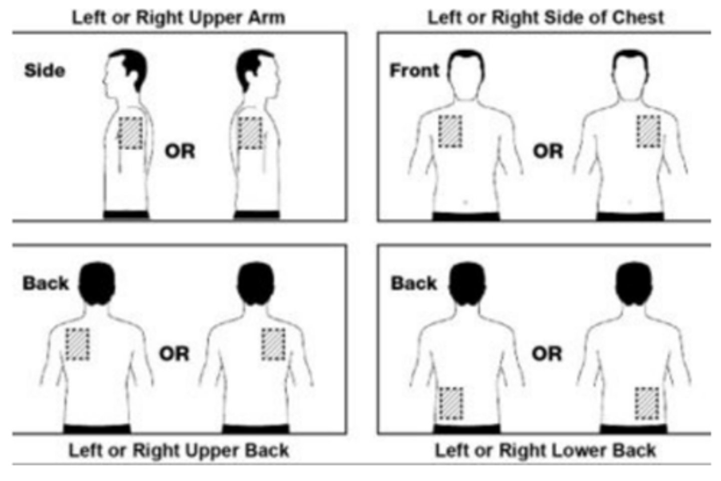 <p>clean, dry, hairless area of the skin on the upper body or upper outer part of the arm</p><p>- wash hands after applying/removing</p><p>- do not cut patches in half</p>