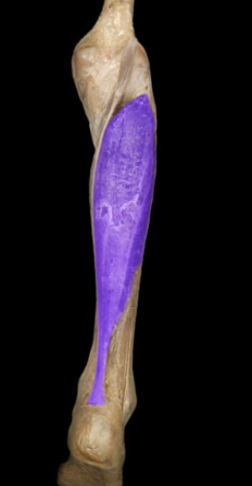 Action:
Plantar flexion of foot
Innervation:
Tibial nerve
Comment:
Calcaneal (Achilles) tendon formed by tendons of gastrocnemius and soleus muscles