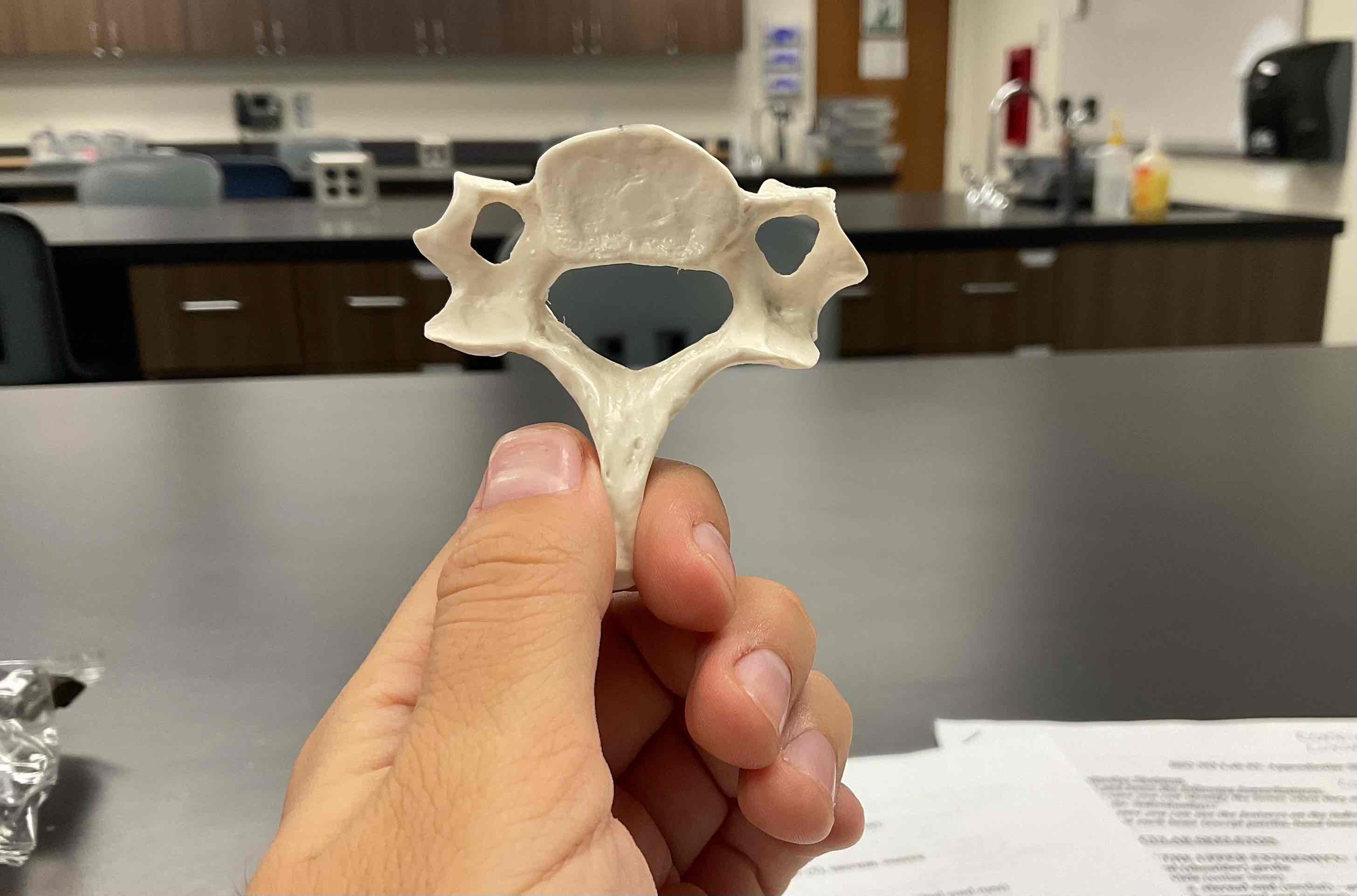 <p>identify the vertebrae </p>