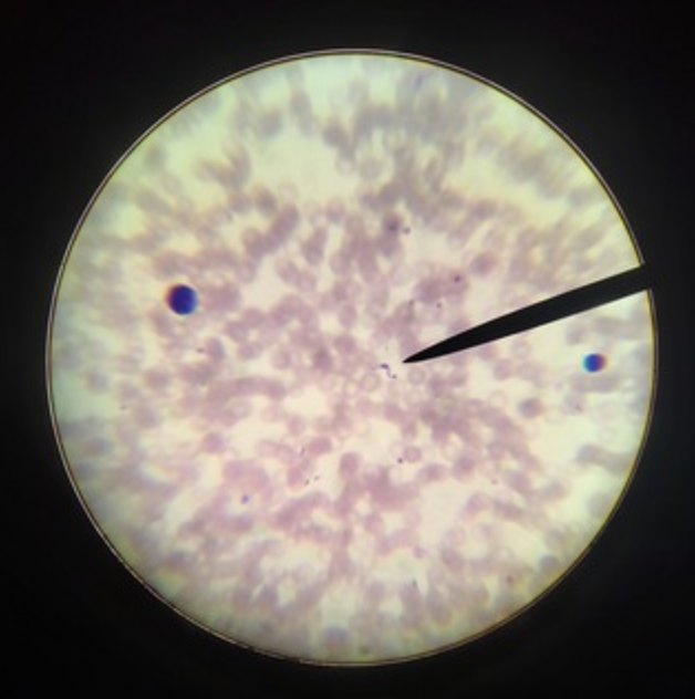 <ul><li><p>identify _b</p></li><li><p>m.o.t</p></li><li><p>infective stage</p></li><li><p>d host, i host</p></li><li><p><u>disease</u></p></li></ul><p></p>