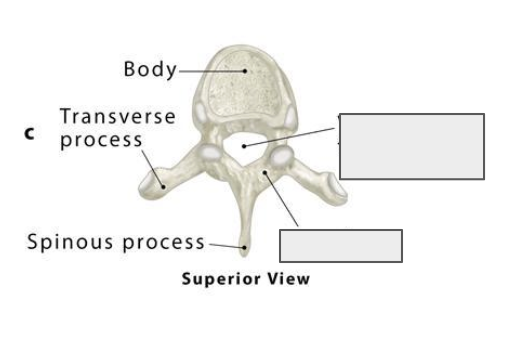 <p>Name the covered landmark</p>