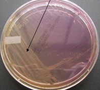 <p><strong>Non- Lactose-fermenter bacteria</strong>, what type of media is it being cultivated on?</p>