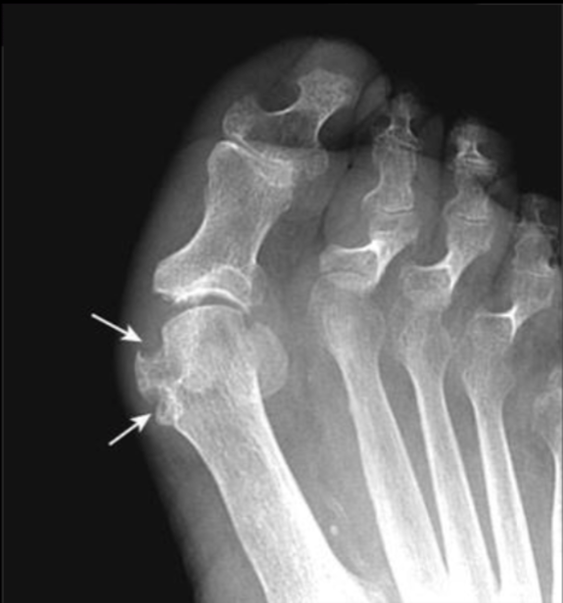 <p>Please identify most likely dx</p>