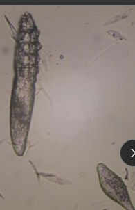 <p><span>Demodicosis</span></p>