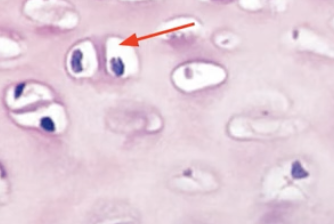 <p>Lacuna</p>