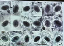 <p>This is the _ stage of Giradia lamblia</p>