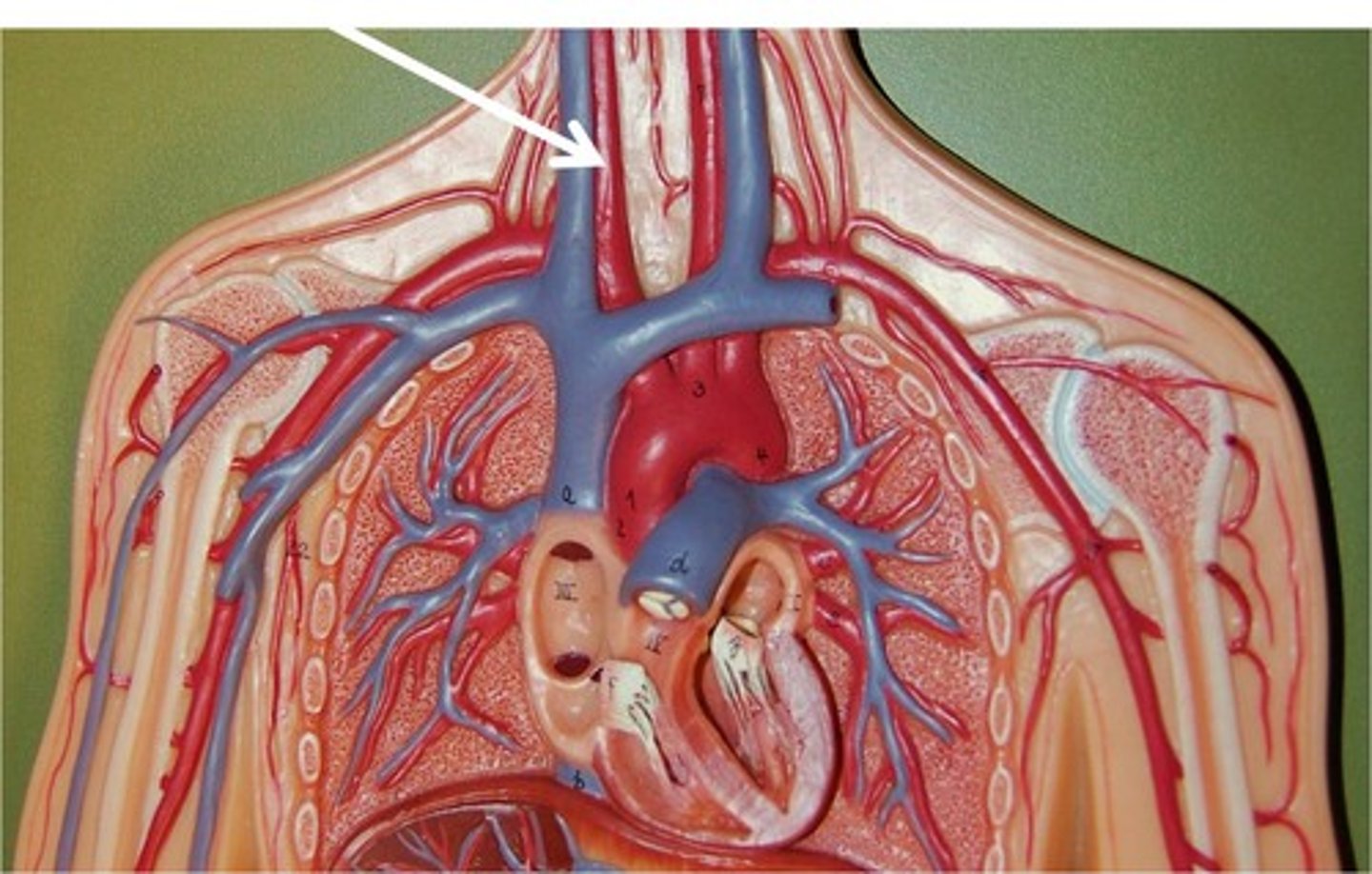 <p>Main arteries that supply blood to the head, face, and neck.</p>