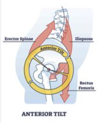 <p>hip flexors and lumbar extensors</p>