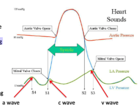 <p>a – atrial systole</p><p>c – closure of mitral valve</p><p>v – atrial filling and emptying</p>